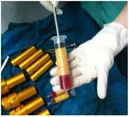 Máy ly tâm PRP và chất béo Taisite, Model: D4-4FAT