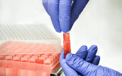 Tủ lạnh âm sâu dạng đứng -80°C MUF 40 Arctiko