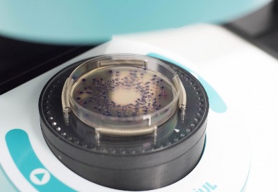 Máy đếm khuẩn lạc tự động và Đo vòng vô khuẩn