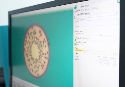 Máy đếm khuẩn lạc tự động và Đo vòng vô khuẩn